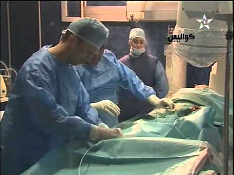 نجاح أول عملية جراحية للقلب في المغرب
