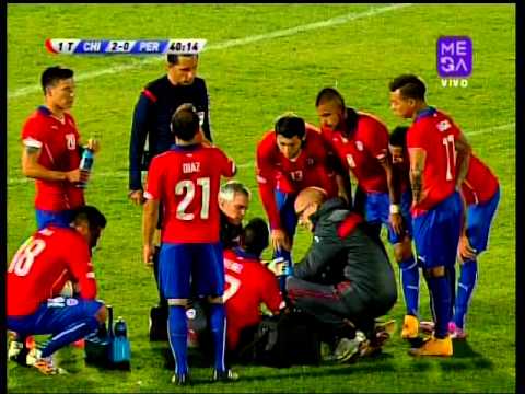 التشيلي ميديل يفقد اسنانه في ضربة بمباراة ودية امام البيرو